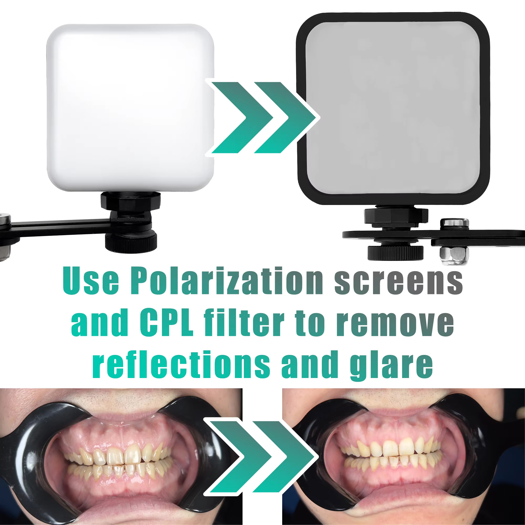 Adjustable Dental Photo Light  - Photography Lighting Essentials recension och pris
